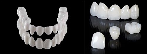So sánh răng sứ kim loại và không kim loại