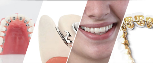 8 điều nên hỏi bác sĩ trước khi chỉnh nha