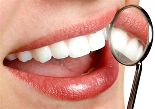 Cầu răng sứ có tốt không ?