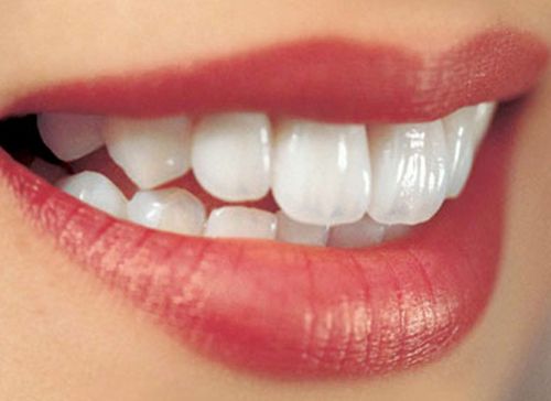 Cấy ghép implant là gì
