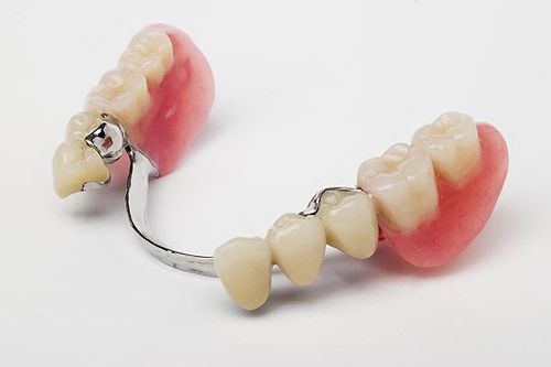 Cấy ghép implant thay thế nhiều răng đã mất