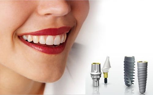 Quy trình cấy ghép implant như thế nào