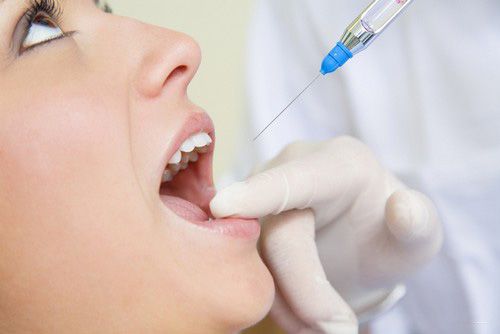 Răng sâu được chữa trị như thế nào ?