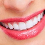 Niềng răng có tác dụng gì ?