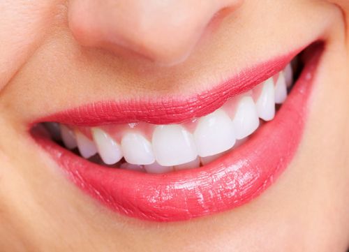 Niềng răng có tác dụng gì ?