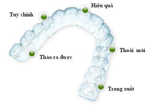Niềng răng không mắc cài Invisalign giá bao nhiêu tiền ?
