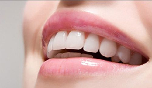 Răng implant khỏe hơn răng thật