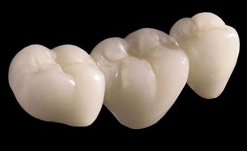 Các loại răng sứ thẩm mỹ hiện nay