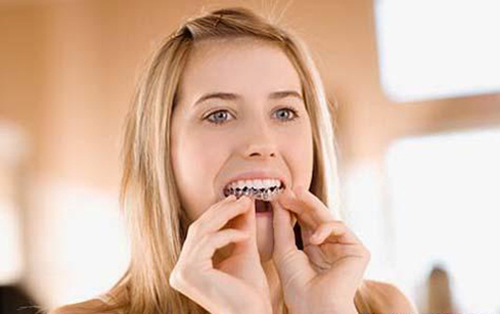 Hướng dẫn cách tẩy trắng răng tại nhà