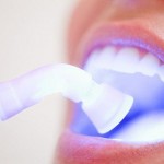 Kỹ thuật phục hồi răng sứ có đau không?