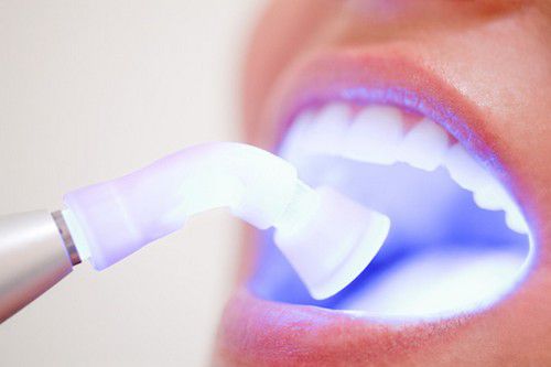 Mài răng có đau không?