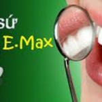 Răng sứ không kim loại E.max