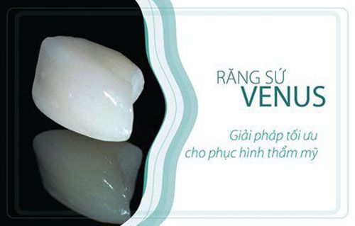 Răng sứ không kim loại Venus công nghệ Mỹ