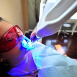 Tẩy trắng răng bằng LaserWhitening