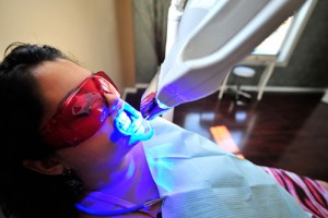 Tẩy trắng răng bằng LaserWhitening
