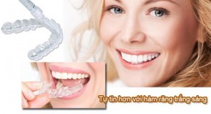 Tẩy trắng răng tại nhà hiệu quả với máng tẩy