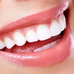 Ưu và nhược điểm của răng sứ Cercon