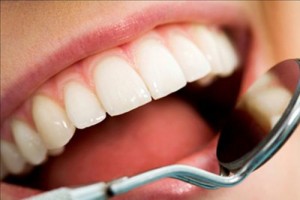 Ngăn ngừa cao răng như thế nào?