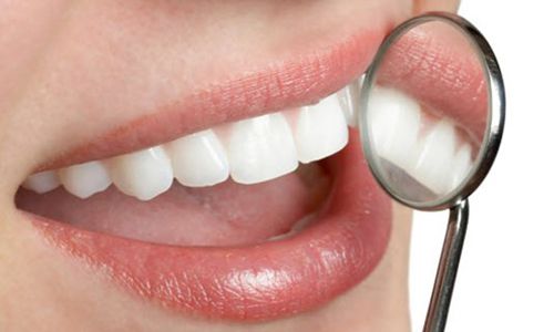 Cạo vôi răng có ảnh hưởng đến men răng không?