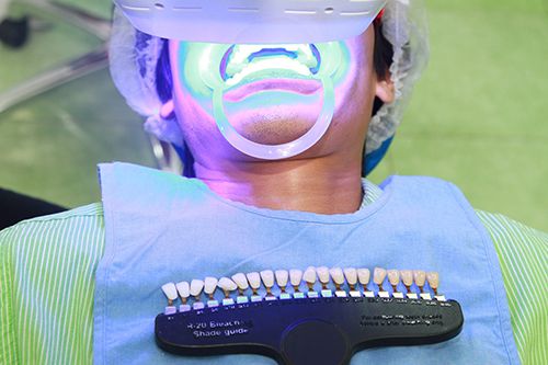 Sự khác nhau giữa tẩy trắng răng và lấy cao răng